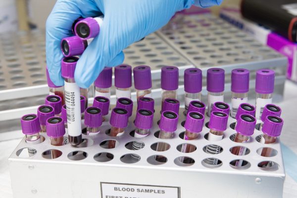 blood, sample, lab-4944424.jpg